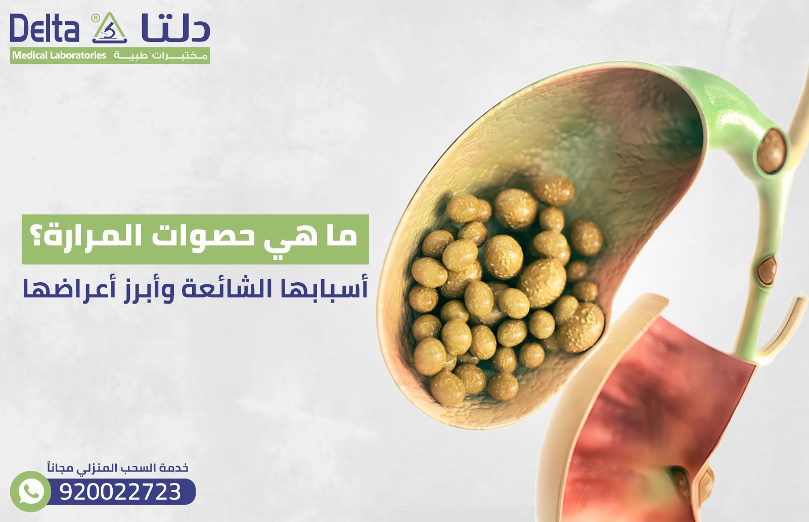 الخطر الكامن وراء تجاهل حصوات المرارة ومضاعفاتها المحتملة