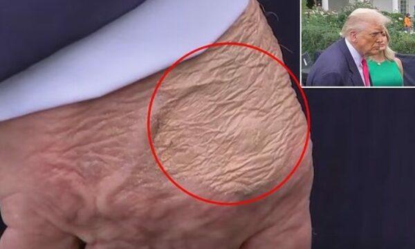 تحليل علمي لأسباب اللجوء إلى التجميل في الظهور العام