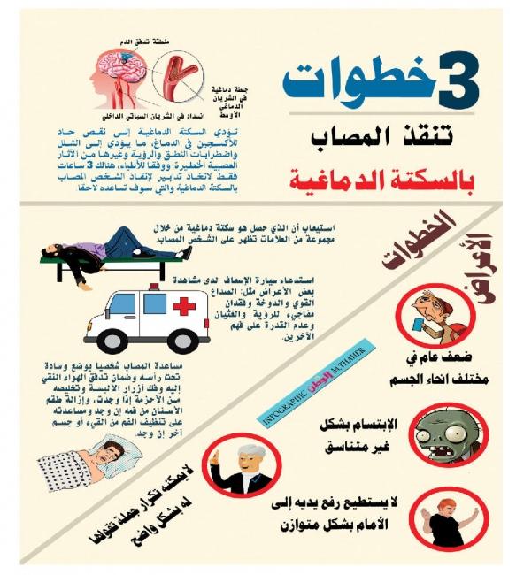 الإجراءات الفورية التي يجب اتخاذها عند ظهور علامات السكتة الدماغية