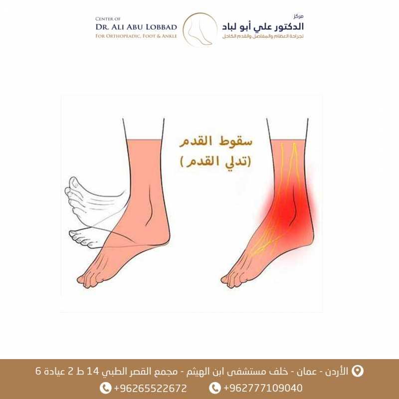 الإجراءات الطبية والعلاجية المتبعة لضمان سرعة التعافي