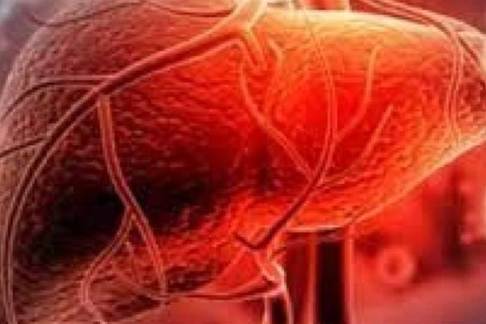 العوامل البيئية والصحية التي تزيد من خطر الإصابة بالتهاب الكبد