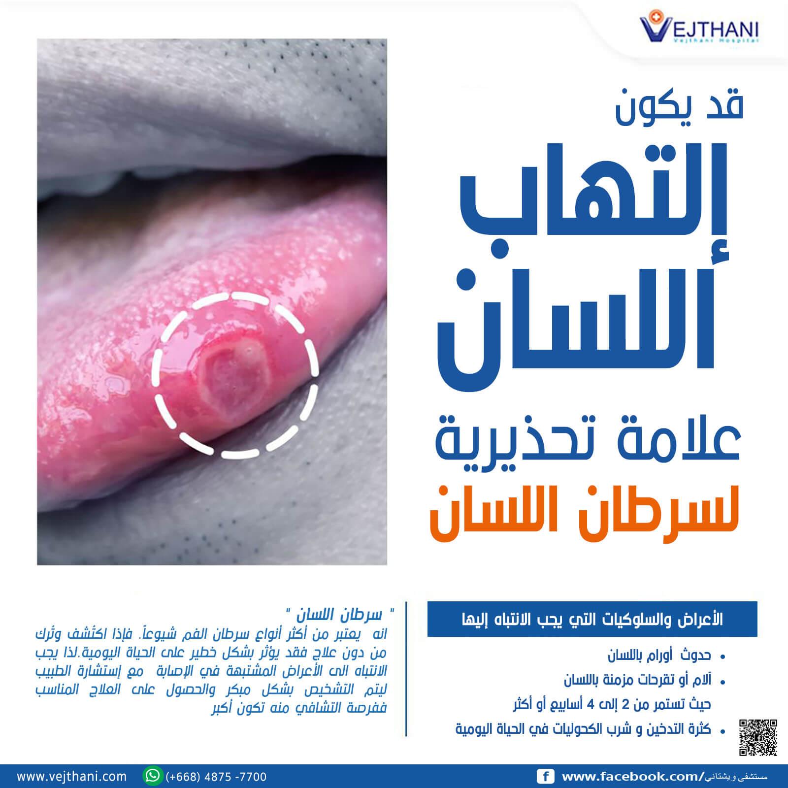 العلاجات المتاحة والتوجيهات الطبية للتعامل مع سرطان اللسان بشكل فعال