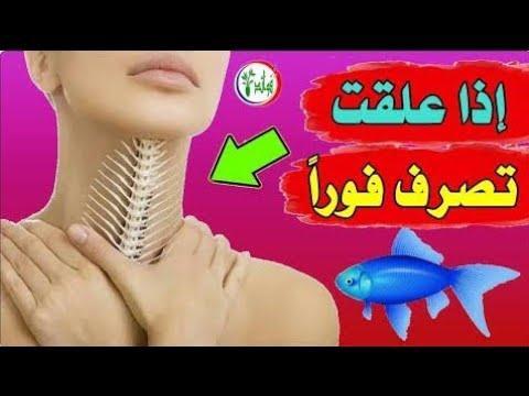 أفضل الممارسات التقليدية والعلمية للتعامل مع شوكة السمك في الحلق
