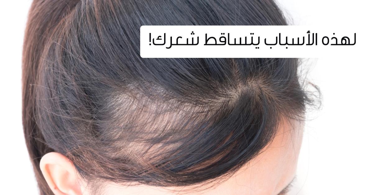 العلاقة بين زيادة الوزن وتساقط الشعر نتيجة التغيرات الهرمونية