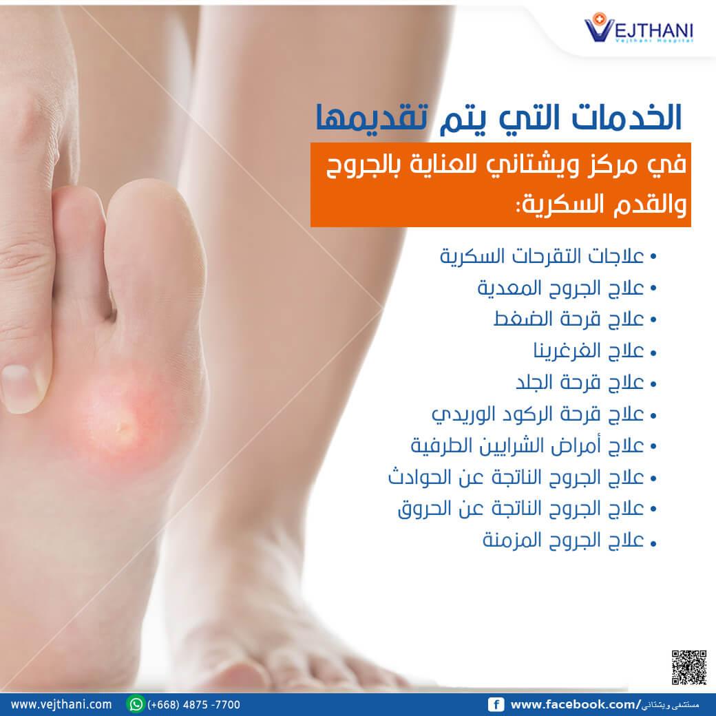 أهمية التعرف المبكر على أعراض القدم السكري