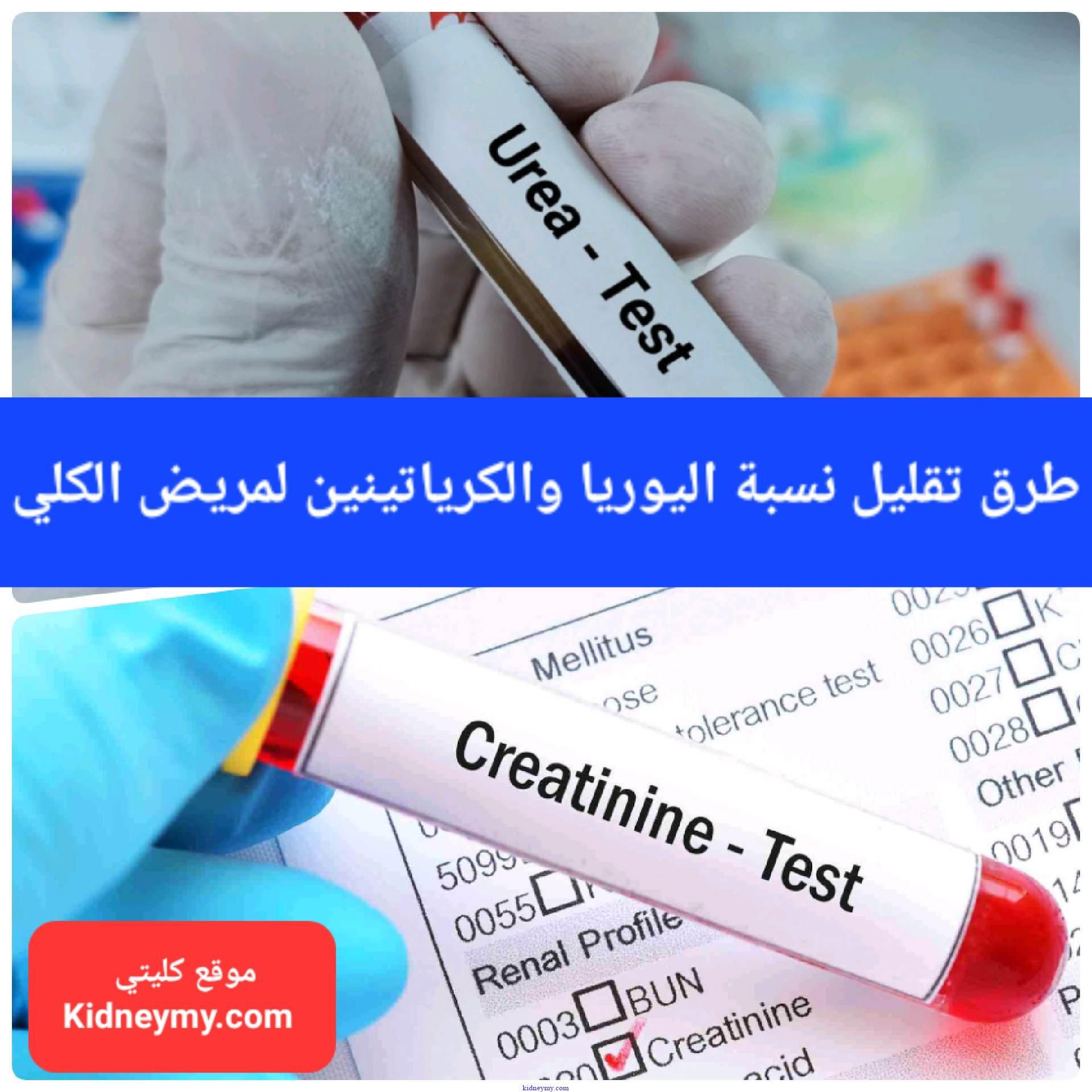 الأساليب الغذائية الفعالة لخفض اليوريا وتحسين وظائف الكلى