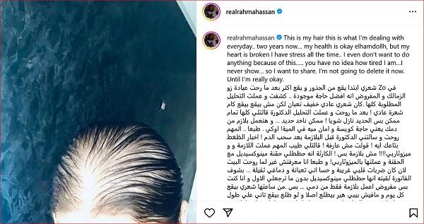 الأسباب المحتملة وراء تساقط شعر رحمة حسن وكيفية التعامل معها