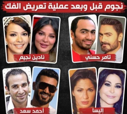 أفضل النصائح لتعزيز الصحة بعد العمليات الجراحية من خلال تجارب النجوم
