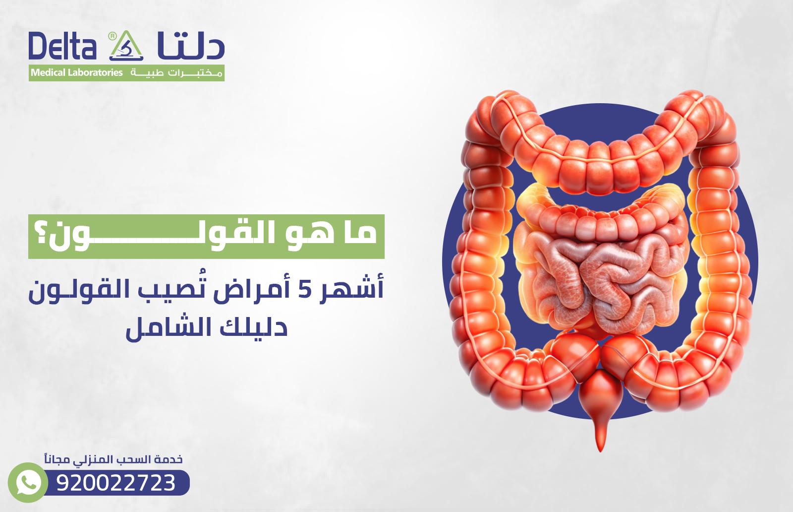 - مرضى القولون وأثر التين الشوكي على الجهاز الهضمي
