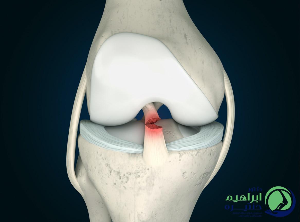 نصائح طبية للتعامل مع الإصابات الخطيرة وسبل التعافي السريع