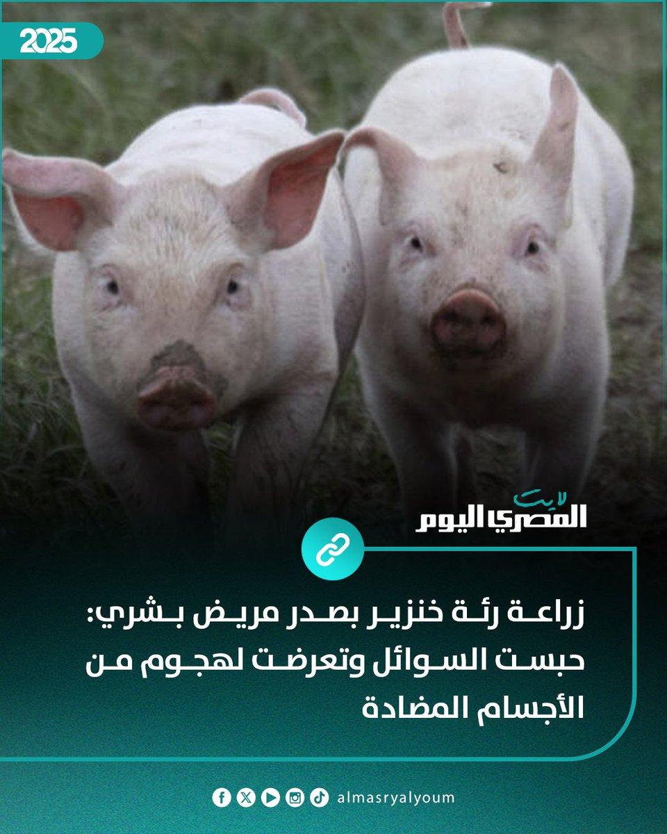 دور الابتكار الطبي في علاج نقص الأعضاء البشرية وفتح آفاق جديدة