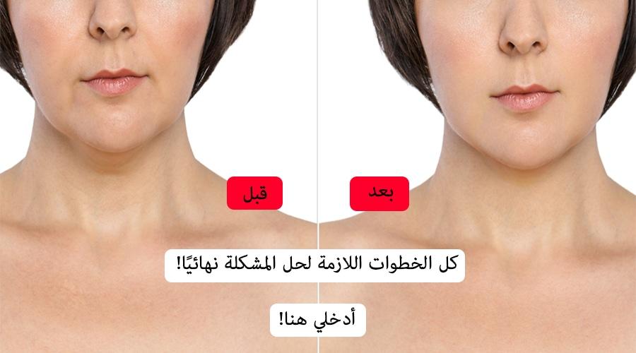 لو وشِك مليان شعر طبيعة نمو الشعر العوامل المؤثرة في كثافة الشعر على الوجه كيفية التمييز بين الشعر الطبيعي والمشكلة الصحية العلاجات والاحتياطات للحفاظ على صحة بشرة الوجه والشعر