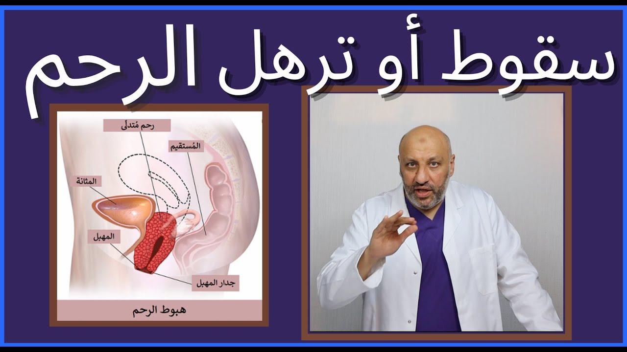 نصائح وإرشادات للوقاية من سقوط الرحم وتعزيز صحة الحوض