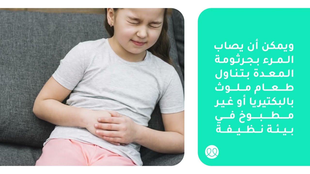 كيفية انتقال الدودة الحلزونية وأهم عوامل الخطر