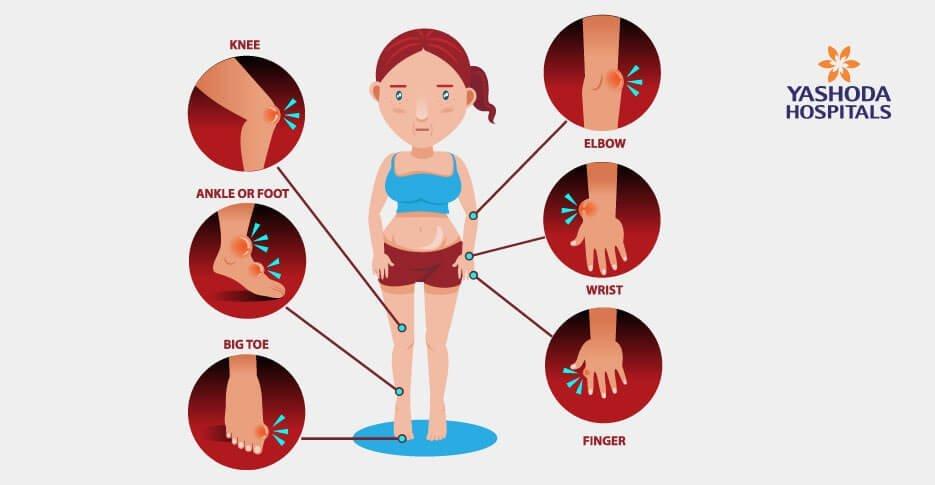 الأطعمة الطبيعية التي تساعد في تقليل مستوى حمض اليوريك في الدم