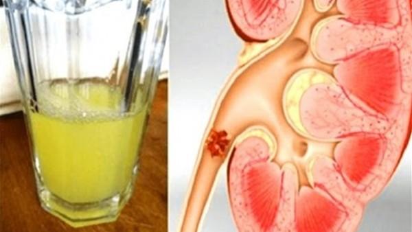 نصائح لاستخدام المشروبات بفعالية ضمن نظام غذائي صحي