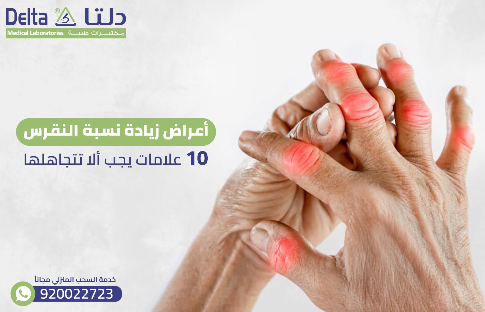 نصائح غذائية وعلاجية للحد من نوبات النقرس وتحسين الصحة العامة