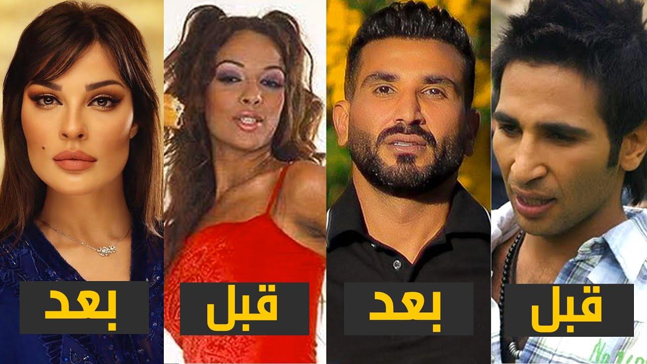 تحليل أسباب الجدل حول عمليات التجميل في الوسط الفني