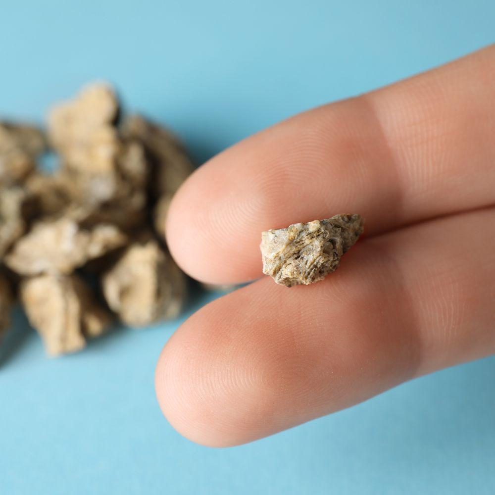 كيفية اختيار المشروب المناسب حسب نوع الحصوات وأعراضها